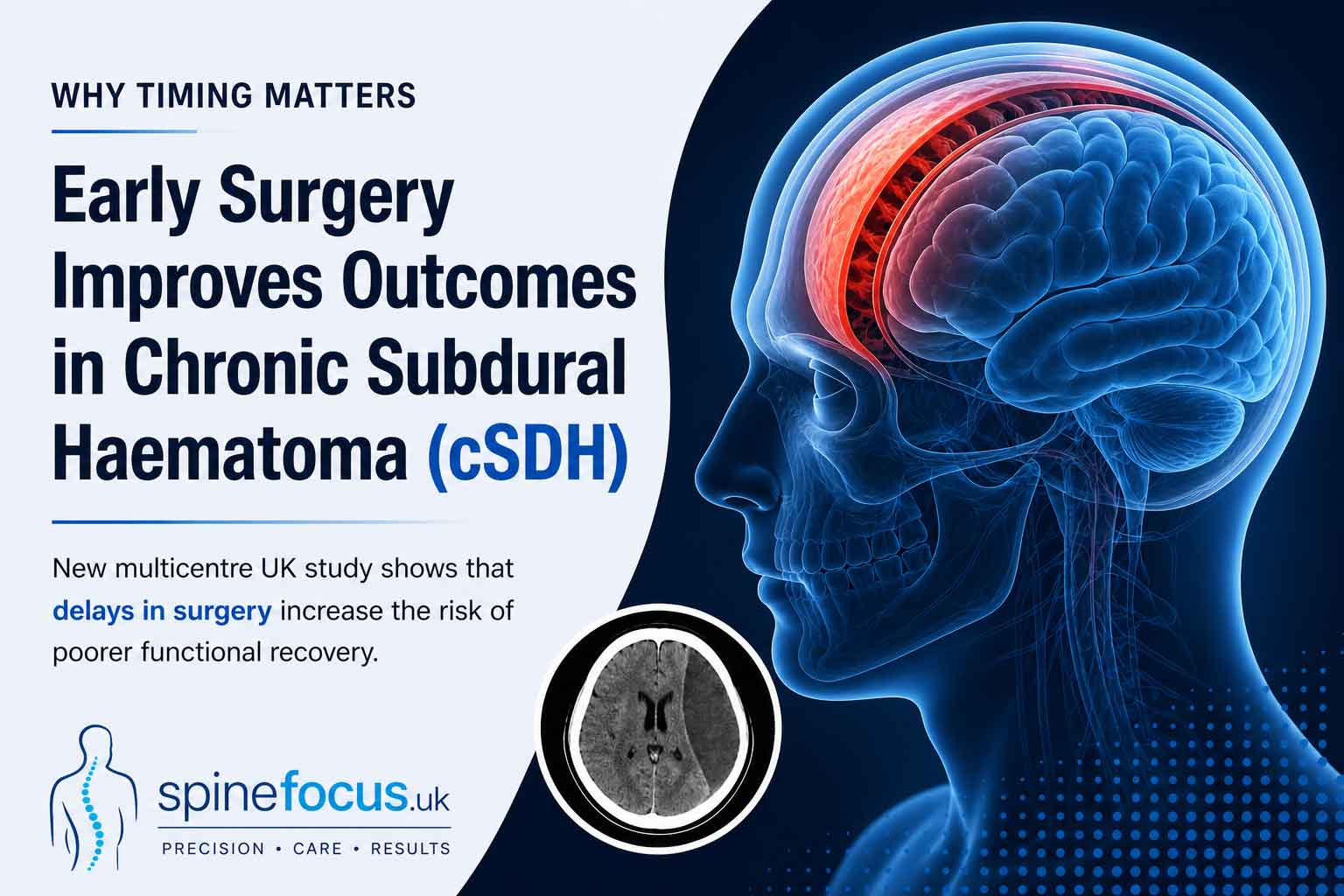 Why Early Surgery Matters in Chronic Subdural Haematoma (cSDH)