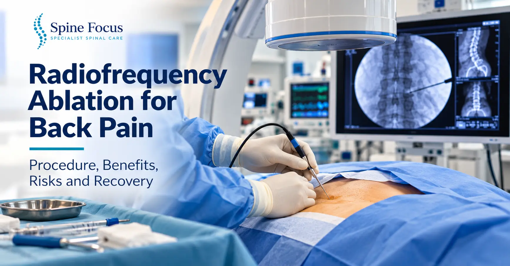 Radiofrequency Ablation for Back Pain: Procedure, Benefits, Risks and Recovery