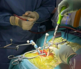 Robotic-assisted spinal fixation surgery using advanced minimally invasive spinal techniques