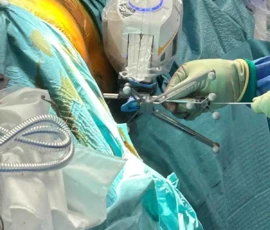 Robotic neurosurgery instrumentation used during minimally invasive spinal surgery procedure