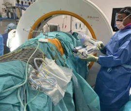 Robotic spine surgery using Mobius imaging and spinal navigation technology