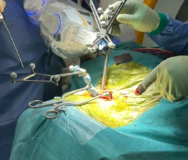 Robotic spine surgery procedure performed by Mr. Taofiq Desmond Sanusi using advanced spinal navigation technology